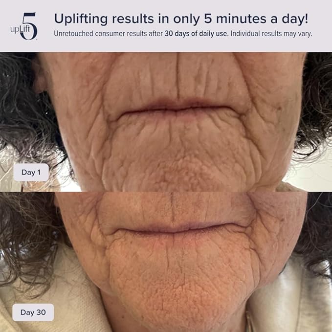 upLift 5 Pulsating Facial Lift | 5 Minute Age Reversal Device, Contours & Improves Facial Structures, Tightening & Toning of Skin