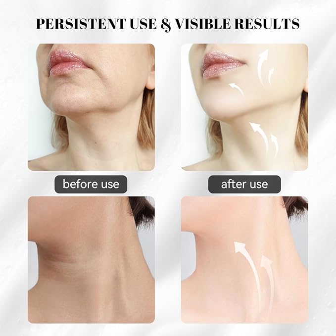 Sveekery Facial Sculptor with Red Light Therapy, Microcurrent & Vibration Massager, Portable Anti-Aging Device for Face and Neck Care, Wrinkle Reducer Face Lift Tool (White) – Valentine’s Gift