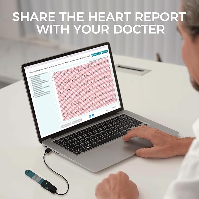 Livenpace 1-Lead Heart Health Monitor at Home, Portable 24 Hours Chest Lead Device with Free AI Analysis & PC Report, Rechargeable Recorder, HHM1