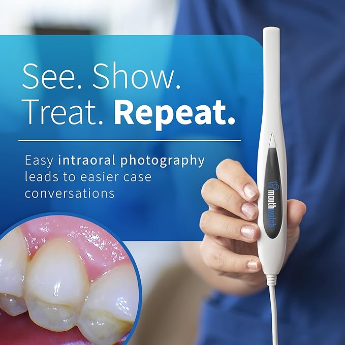 MouthWatch Intraoral Camera, Crystal Clear Images with an Easy to Use, Fast, Single Button Operation Dental Camera, Compatible with Over 50 Dental Imaging Suites, Lightweight and Ergonomic, 31 Grams