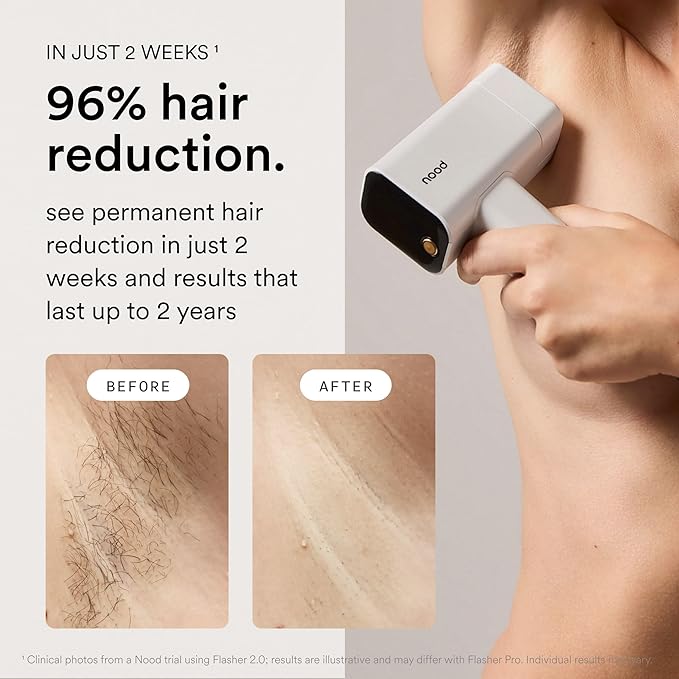 Nood™ NEW Flasher Pro — IPL Laser Hair Removal Device & Anti-Aging Red Light Therapy for Women & Men — Pain-free, Permanent, Visible Results After First Use & Works Everywhere Hair Grows — Matte Black
